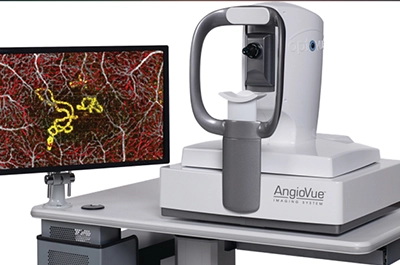 Optische Kohärenztomographie